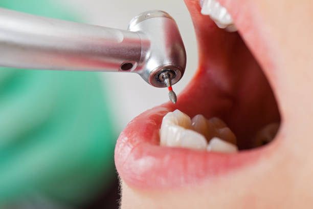 Best Dental Abscess Treatment in Braidwood, IL